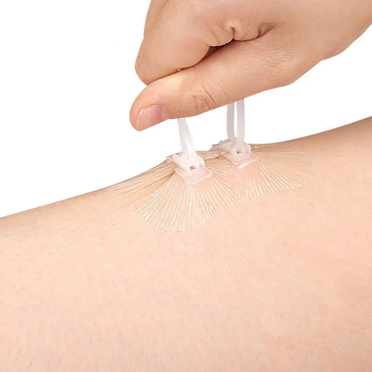 Adhesive Wound Care Zip Sutures Bandaids without Stitches First Aid Zipper Laceration Repair Emergency Laceration Closures