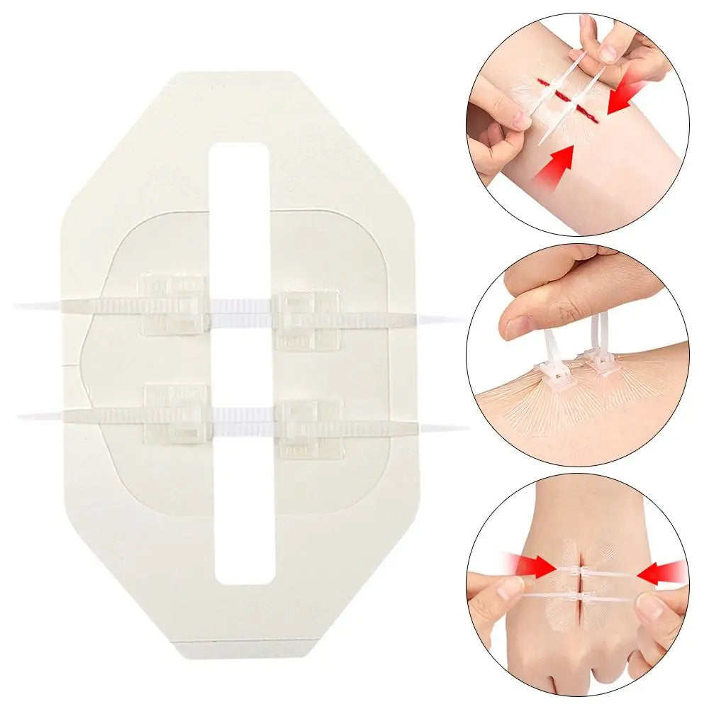 Adhesive Wound Care Zip Sutures Bandaids without Stitches First Aid Zipper Laceration Repair Emergency Laceration Closures