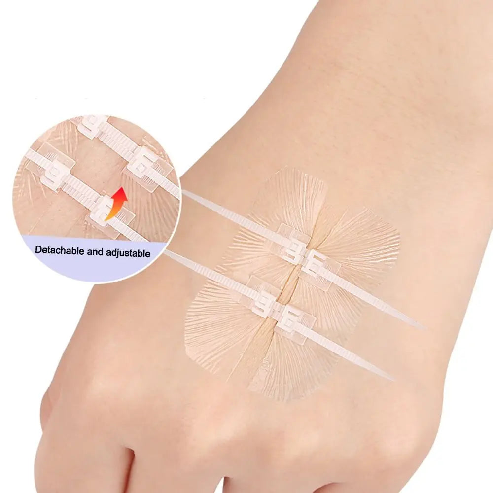 Adhesive Wound Care Zip Sutures Bandaids without Stitches First Aid Zipper Laceration Repair Emergency Laceration Closures