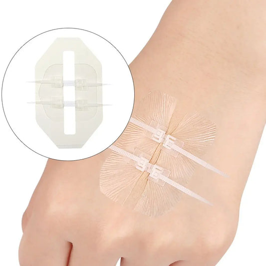 Adhesive Wound Care Zip Sutures Bandaids without Stitches First Aid Zipper Laceration Repair Emergency Laceration Closures