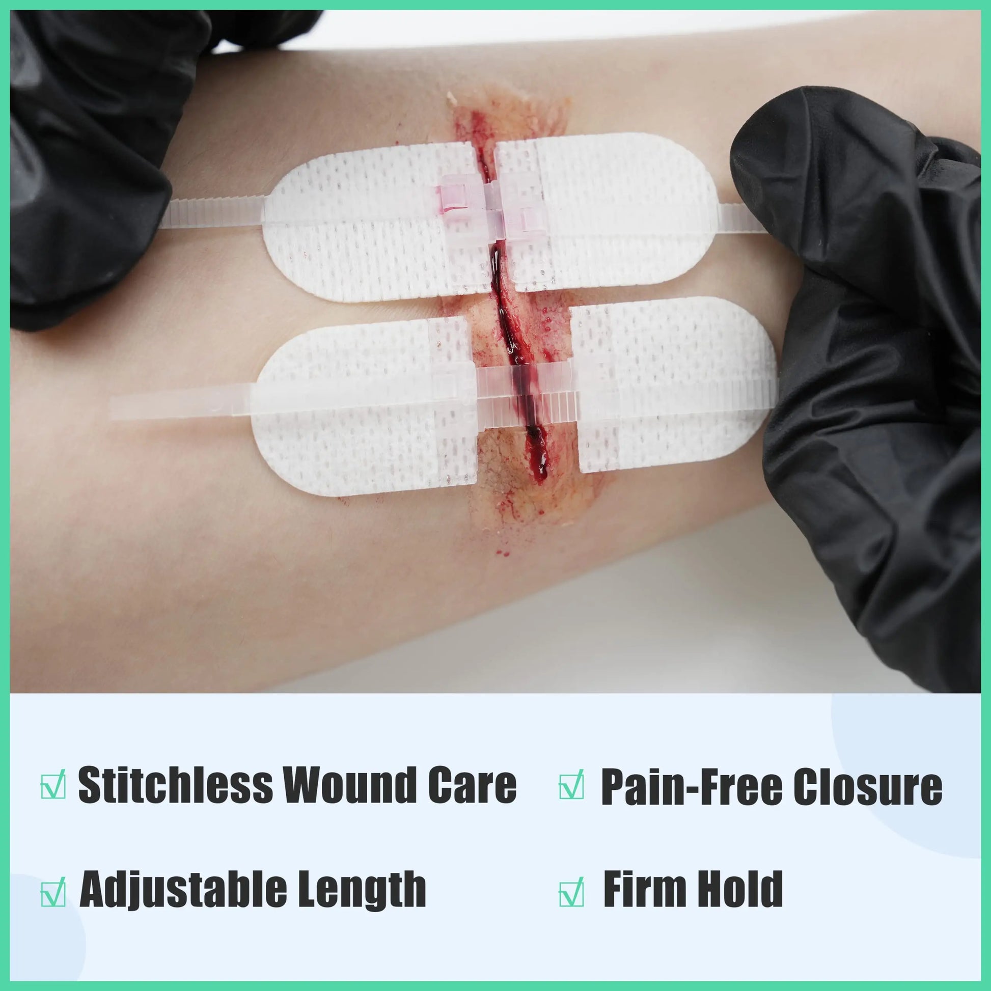 Zip Stitch 6Pcs with Wound Dresssings, Wound Closure Strips without Suture, Zipstitch Laceration Closure Kit